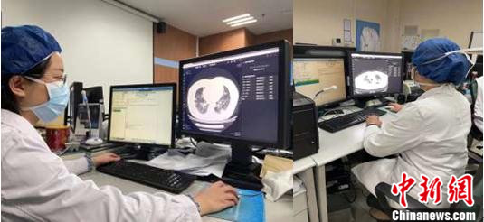 医生在电脑终端浏览患者CT影像及病情评估 医生在电脑终端浏览患者CT影像及病情评估